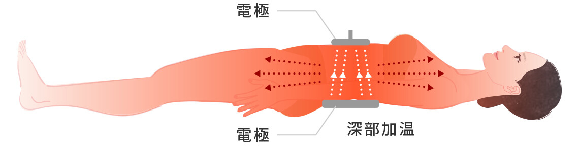 頭からつま先まで広範囲を温める